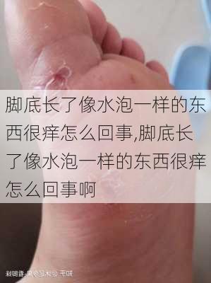 脚底长了像水泡一样的东西很痒怎么回事,脚底长了像水泡一样的东西很痒怎么回事啊-第1张图片-花卉百科