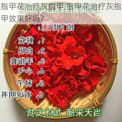 指甲花治疗灰指甲,指甲花治疗灰指甲效果好吗?